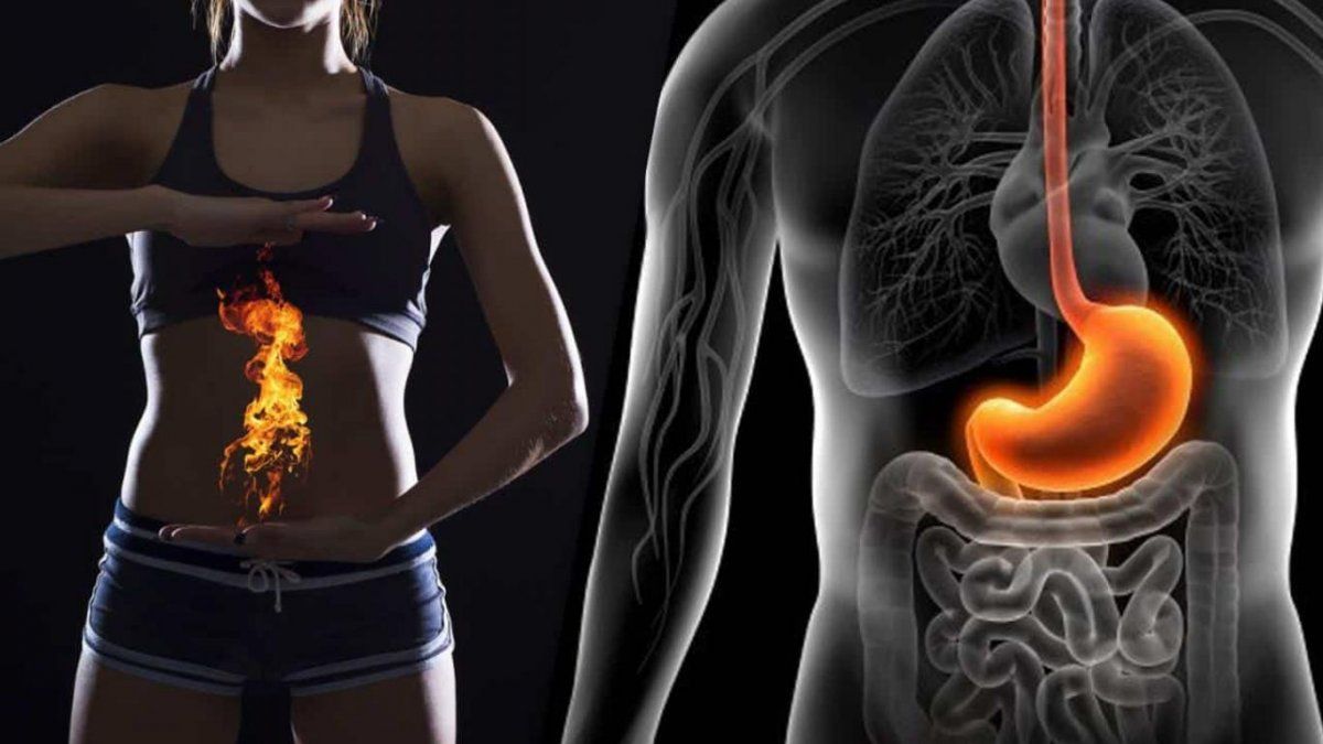 Cuáles son los problemas gastrointestinales más comunes