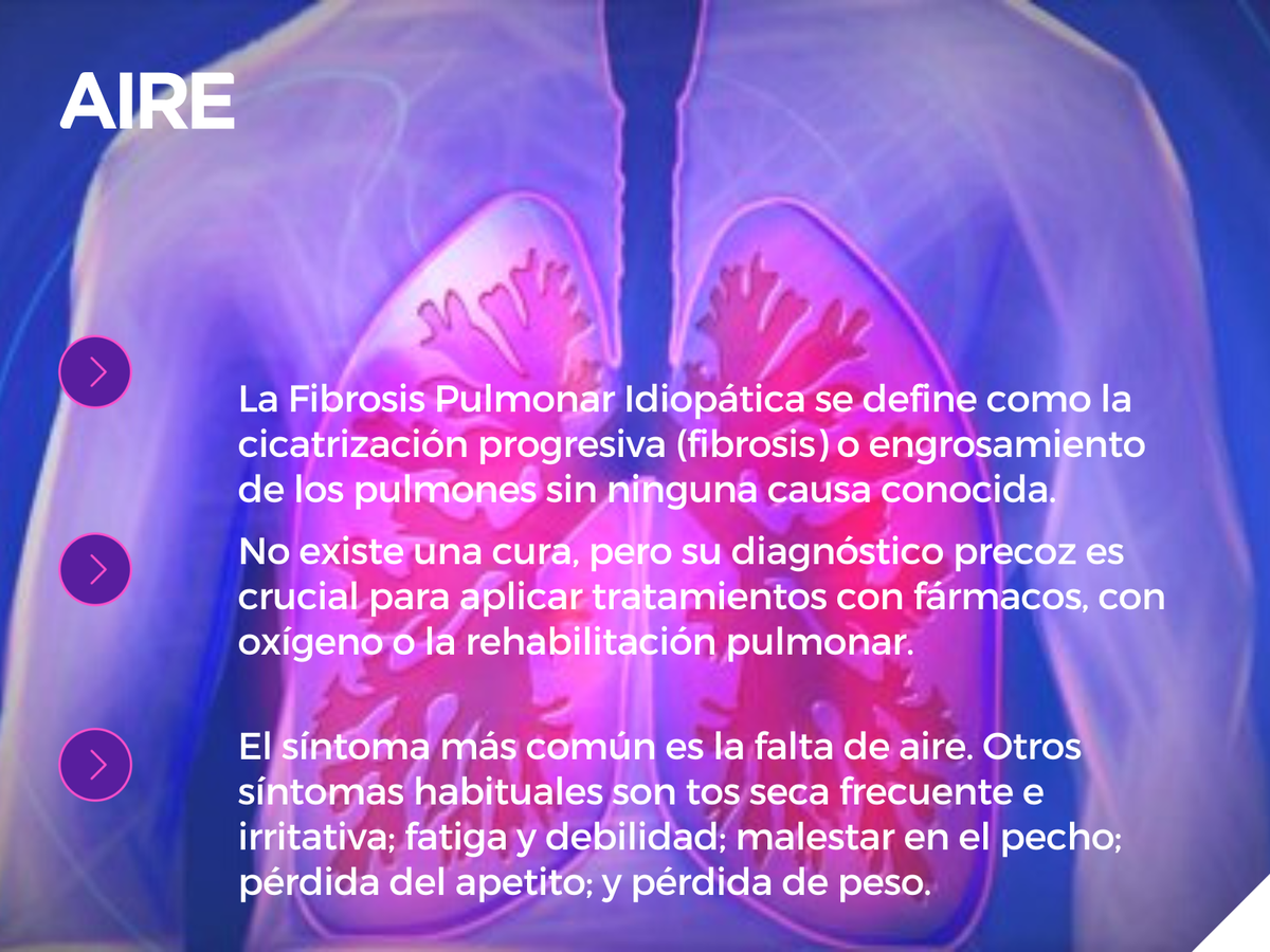 Qué es la fibrosis pulmonar idiopática una enfermedad silenciosa que