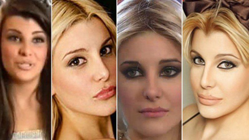 Las Famosas Argentinas Antes Y Despu S De Las Cirug As