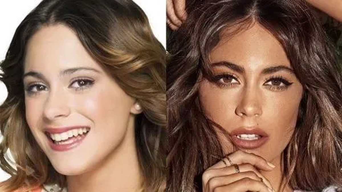 El Incre Ble Antes Y Despu S De Tini Stoessel El Retoque Est Tico Que