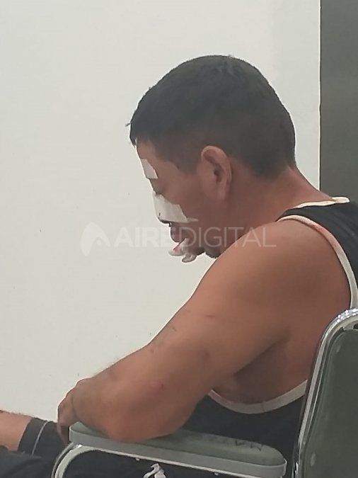 El hombre se encuentra en terapia intensiva hace una semana