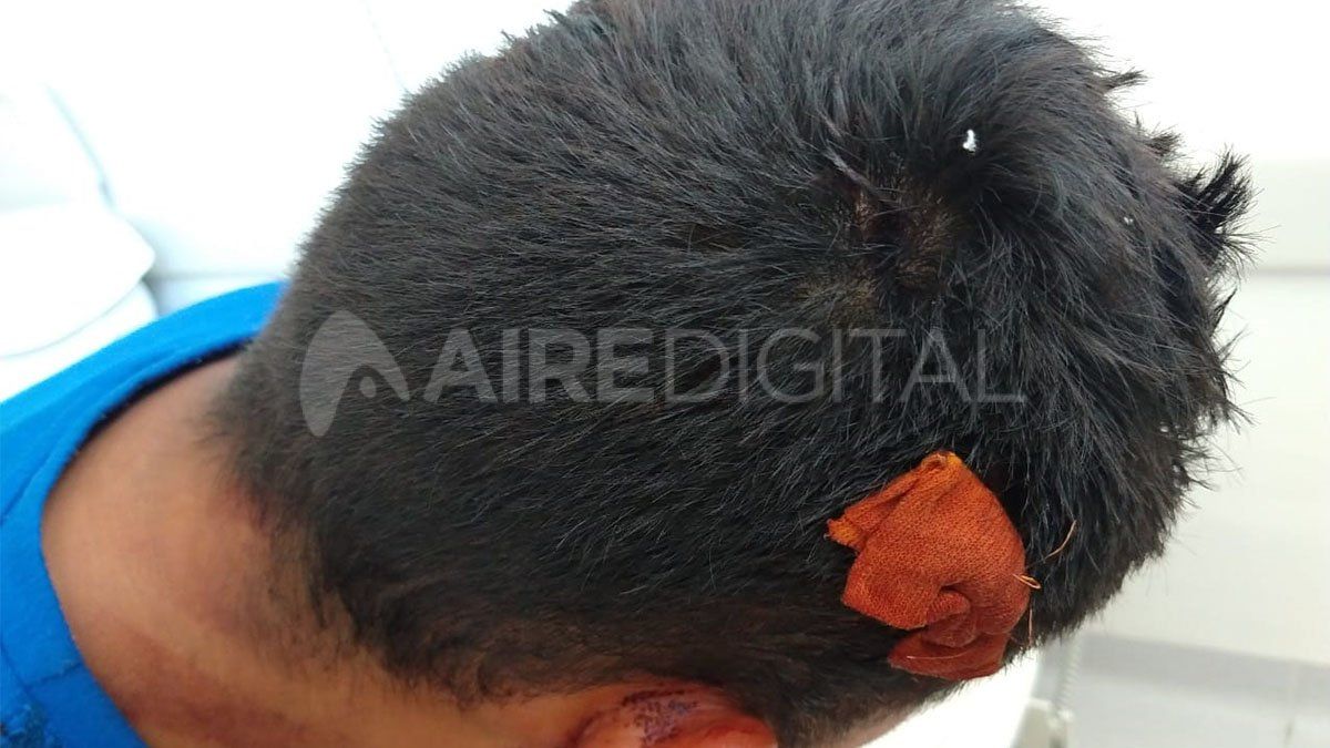 A Marcos lo golpearon y le dispararon