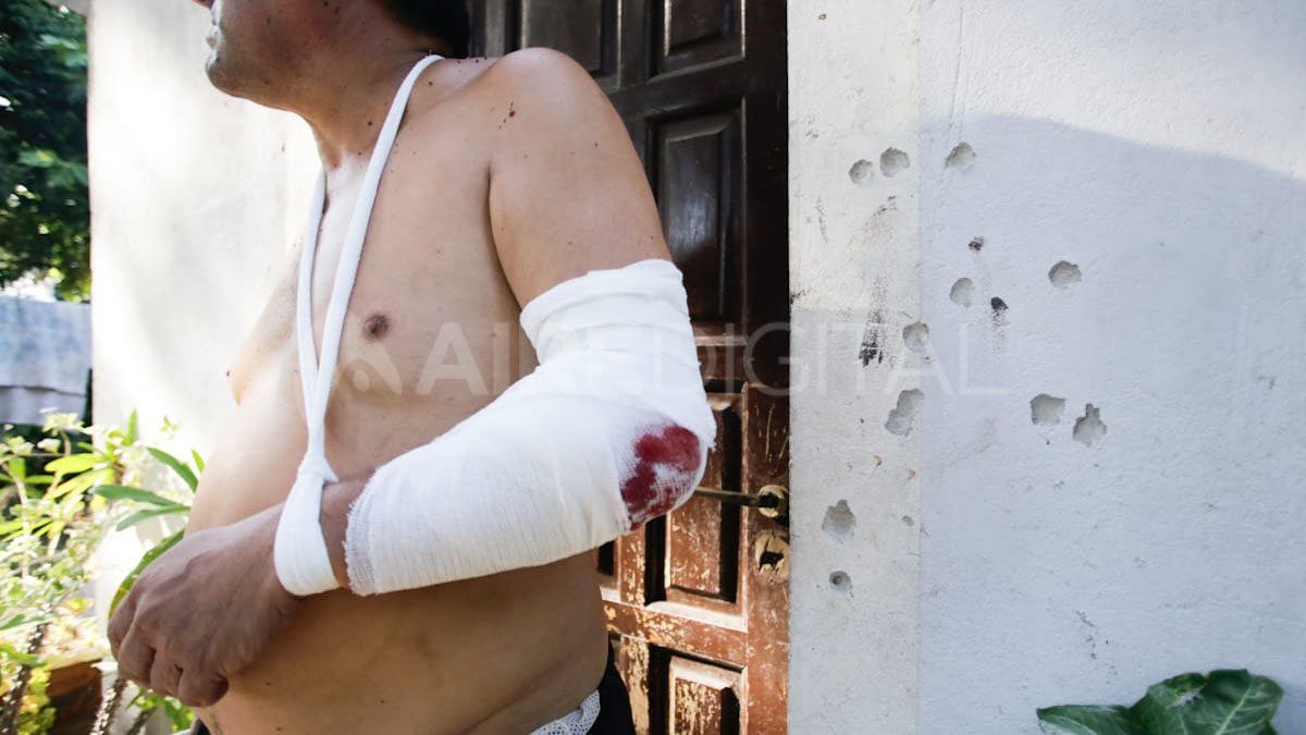 Vecino herido en la balacera- La Guardia