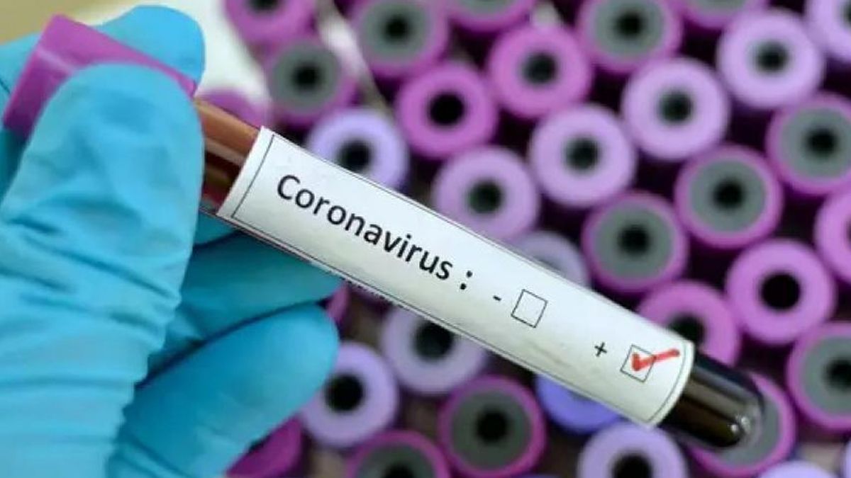 Sued precisó que en la Argentina se realizan unos 1.600 test de coronavirus por día.