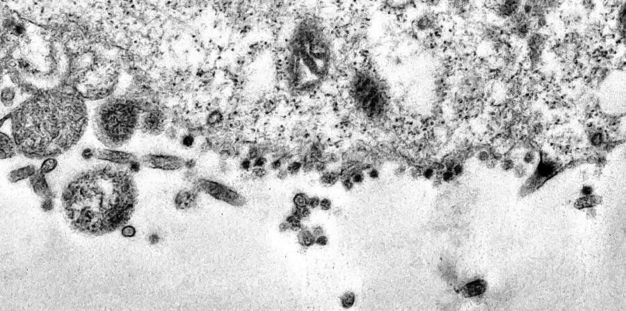 Los puntos negros son patógenos del SARS-CoV-2 mientras intentan infectar el citoplasma de las células. (EFE) 