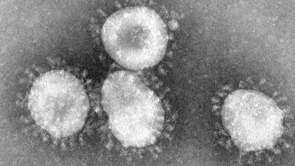 Coronavirus.