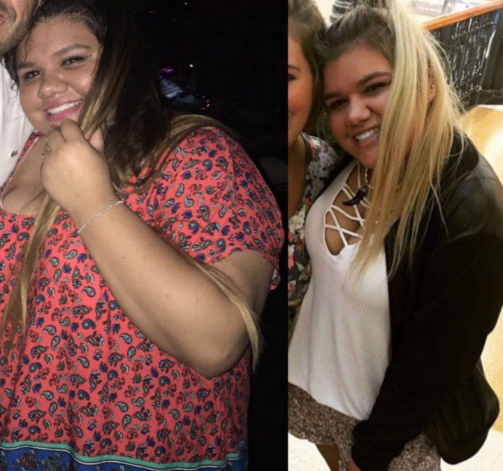 La impactante transformación de Morena Rial. A la izquierda, antes de su bypass. A la derecha, rubia y con una figura totalmente diferente.