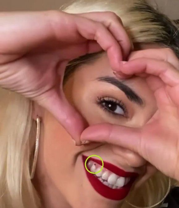 A Lali le descubrieron un pedacito de comida en su diente y no se la dejaron pasar.