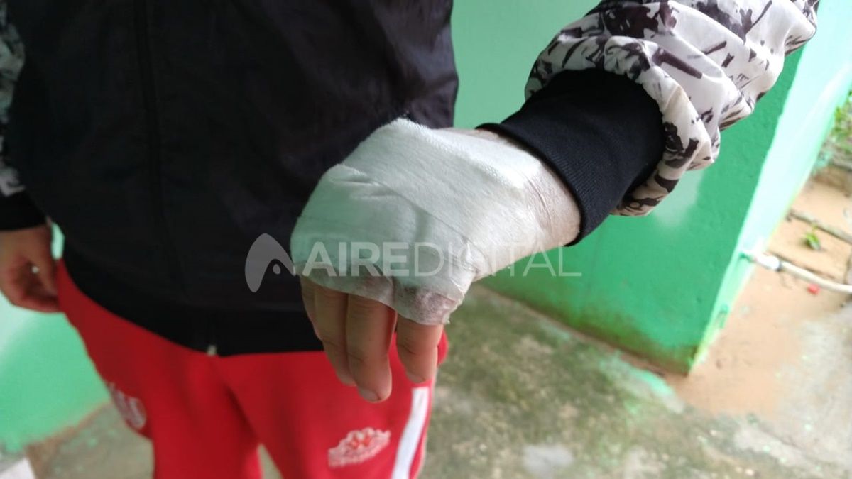 Trataron de apuñalarlo en el abdomen, se cubrió con la mano y recibió cortes en los dedos.