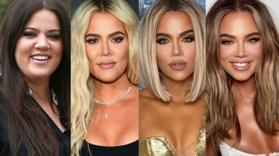  Los cambios de Khloé Kardashian 