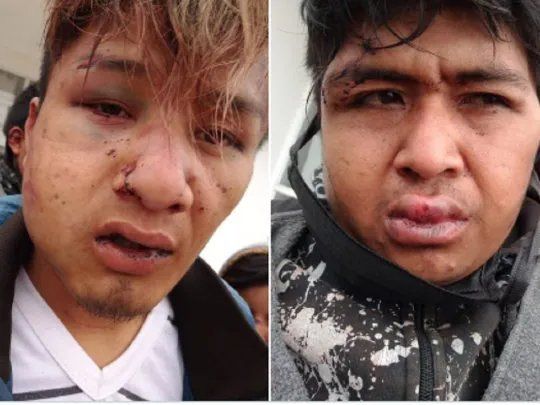 Dos de los jóvenes brutalmente golpeados por la policía de Chaco.