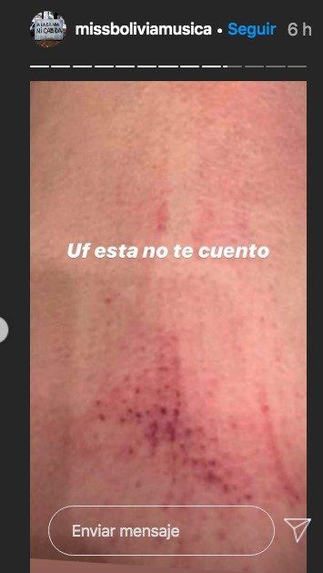 Captura de instagram