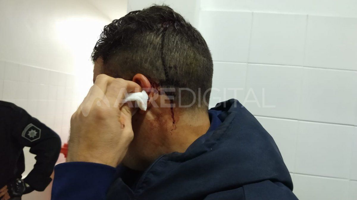 El joven recibió varios golpes, incluso en su cabeza