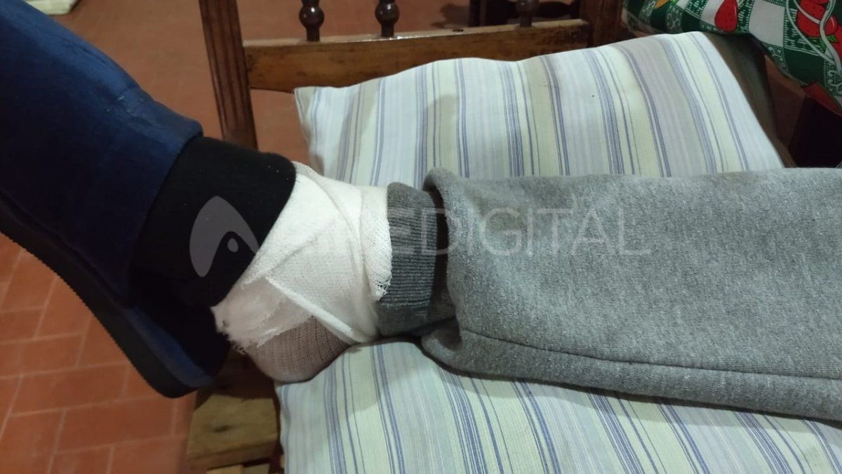 El hombre de 52 años recibió un disparo de arma de fuego en el tobillo