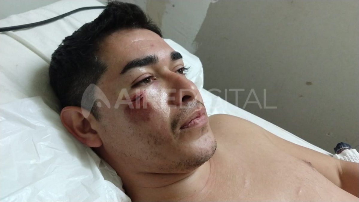 Tres disparos recibió el dueño del taller al forcejear con el ladrón