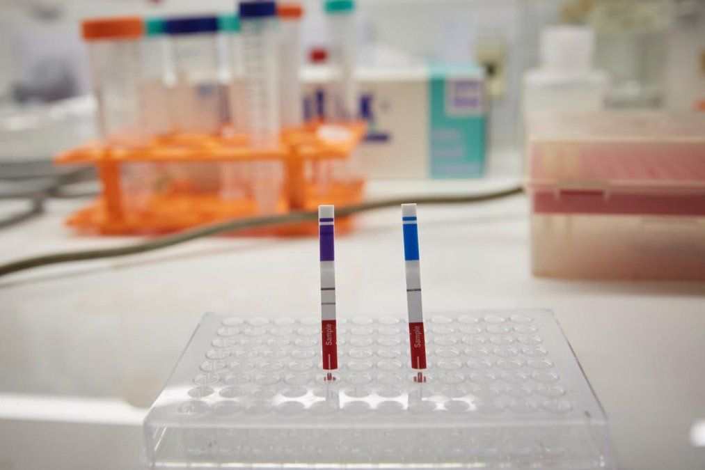 El kit funciona en tres pasos a partir del hisopado nasofaríngeo de la persona a diagnosticar.