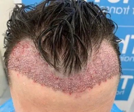 Subió las fotos a las redes sociales