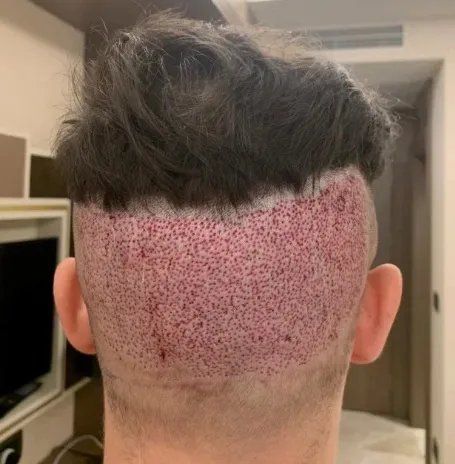 Los tremendos resultados de la cirugía