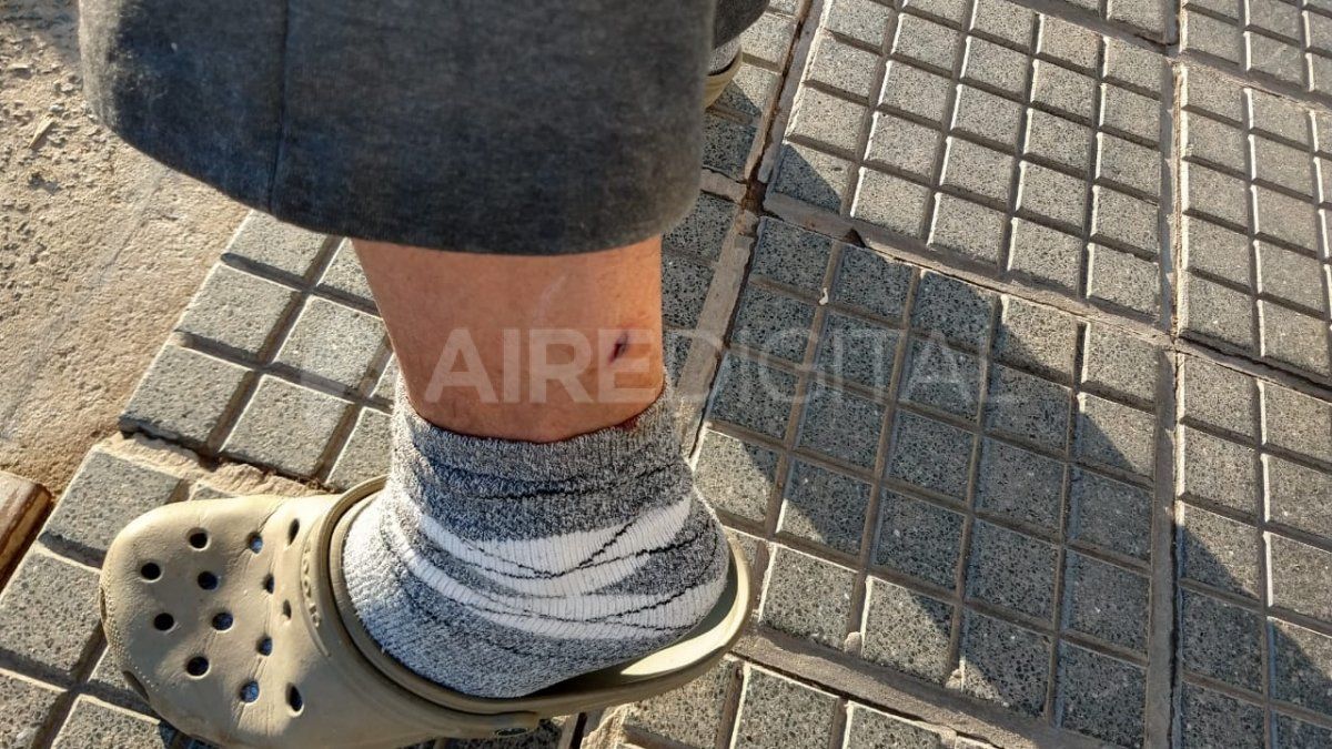 El ladr&oacute;n dispar&oacute; el arma y la bala roz&oacute; la pierna de Gabriel