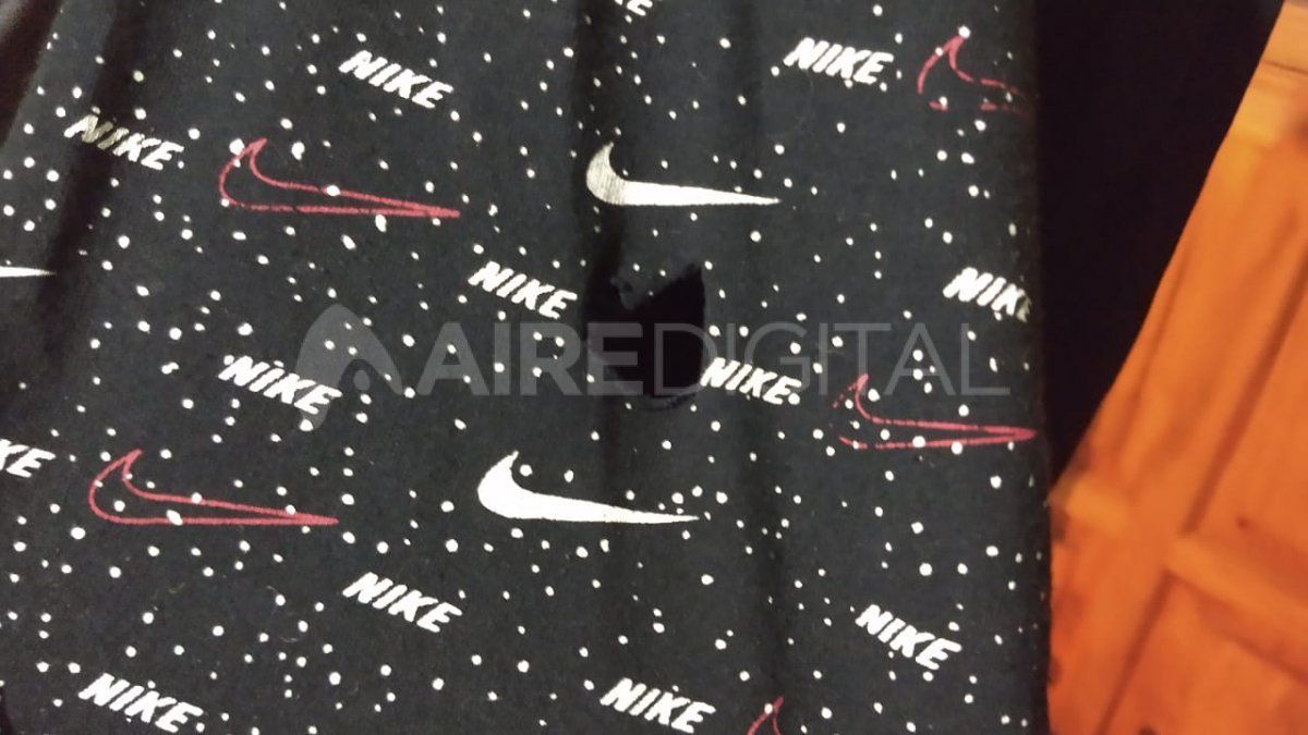 La ropa que tenía la víctima quedó agujereada por el disparo