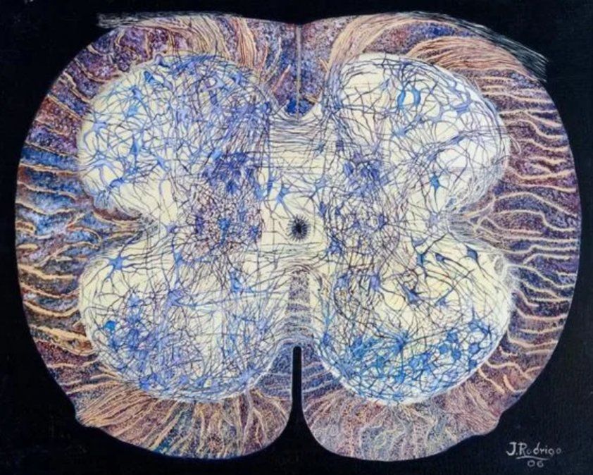 Resultados en imágenes de la actividad cerebral durante el proceso.