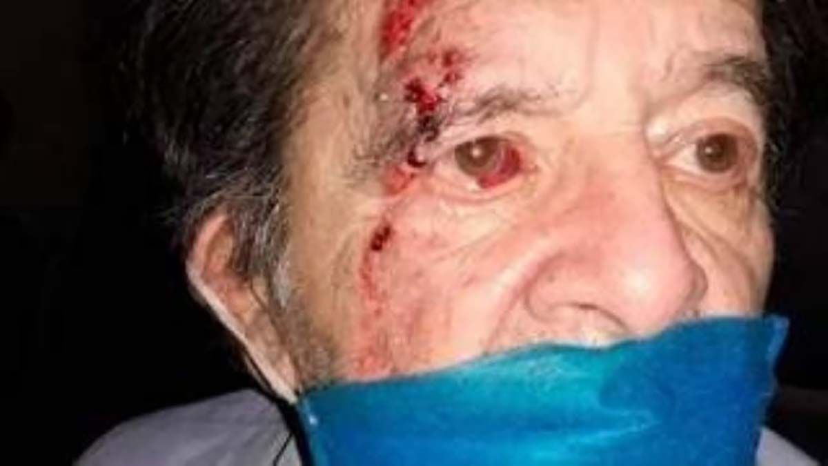 El jubilado tuvo un derrame en su ojo tras recibir una trompada del guardia de seguridad de un supermercado en Córdoba.