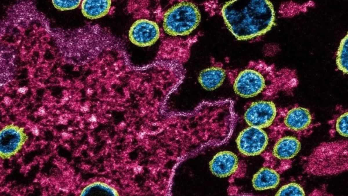 Una imagen de microscopio electrónico de transmisión de un caso de coronavirus en los EE.UU.
