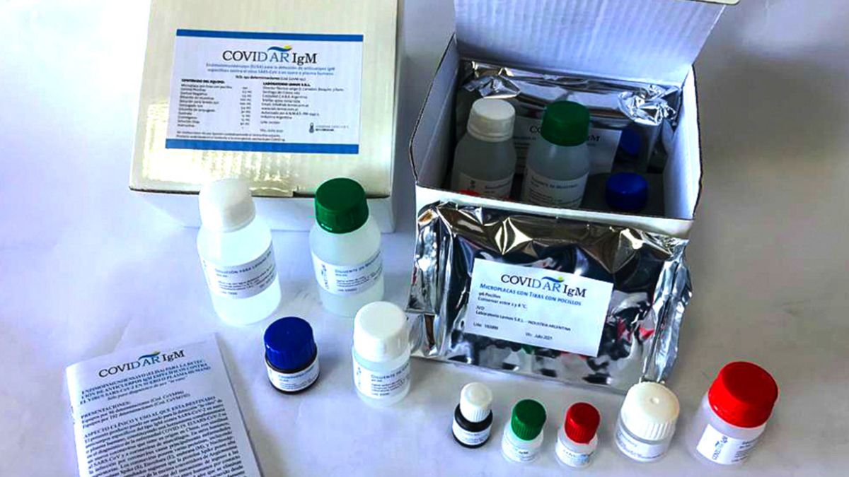 El nuevo test serológico para COVID-19, desarrollado por los científicos del Instituto Leloir y del CONICET, detecta la inmunoglobulina IgM, que es el primer anticuerpo que genera el sistema inmune para combatir una infección