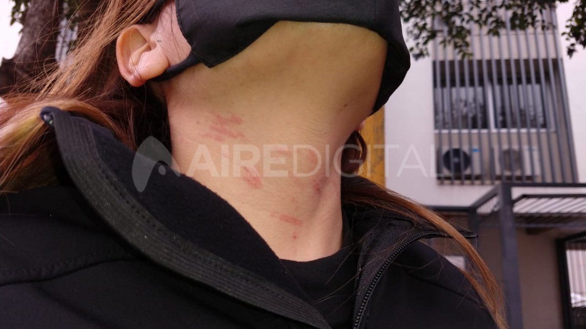 Las marcas en la víctima tras el violento ataque