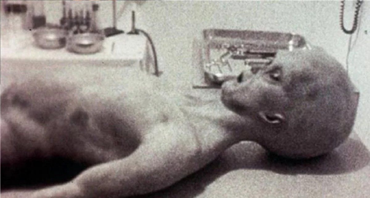 La autopsia de uno de los extraterrestres. Después de muchos análisis se cree que no es un alienígena, pero las dudas persisten.