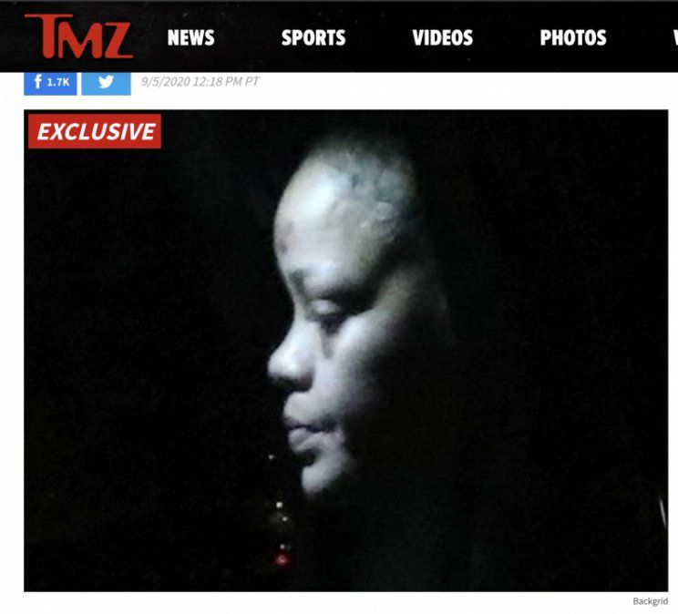 Rihanna se lastimó la frente y la cara 