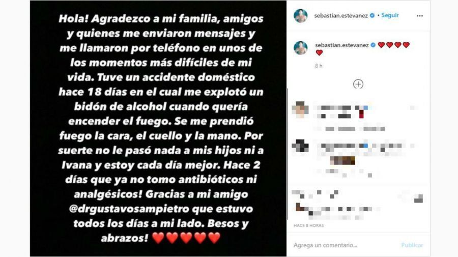 Sebastián Estevanez dio detalles del tremendo accidente doméstico que vivió cuando un bidón de alcohol le explotó en la mano