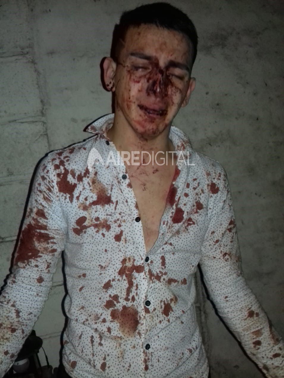 Joven golpeado en un boliche