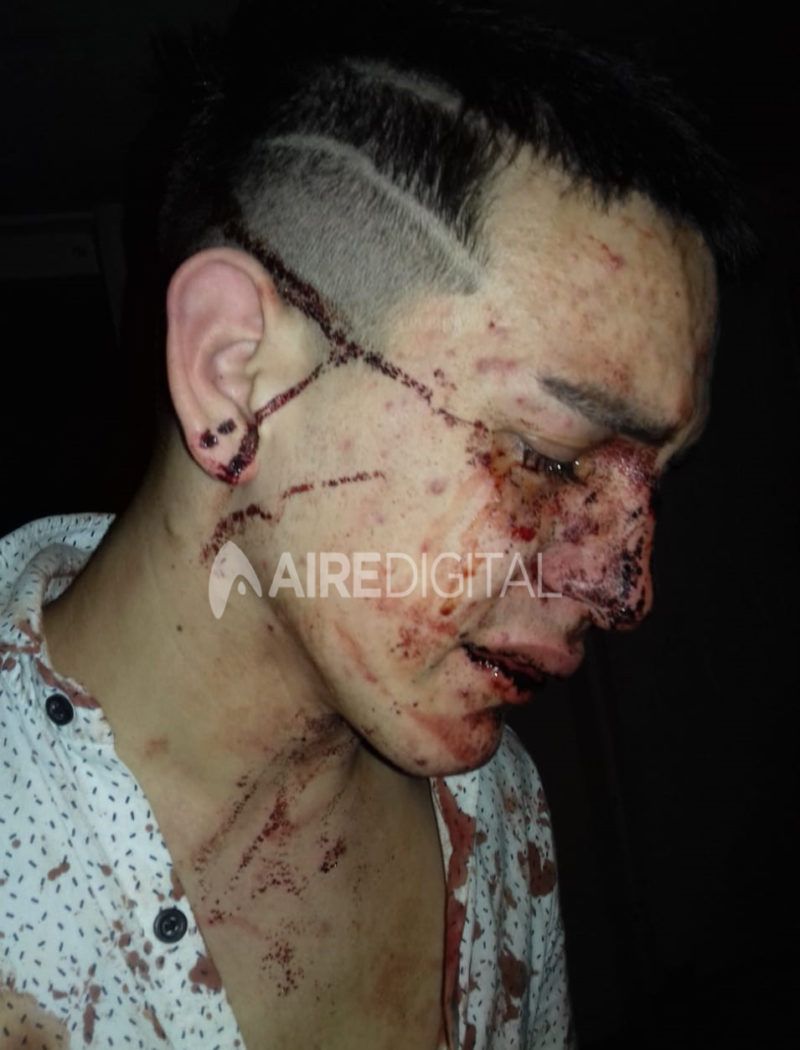 El relato del joven golpeado en el boliche