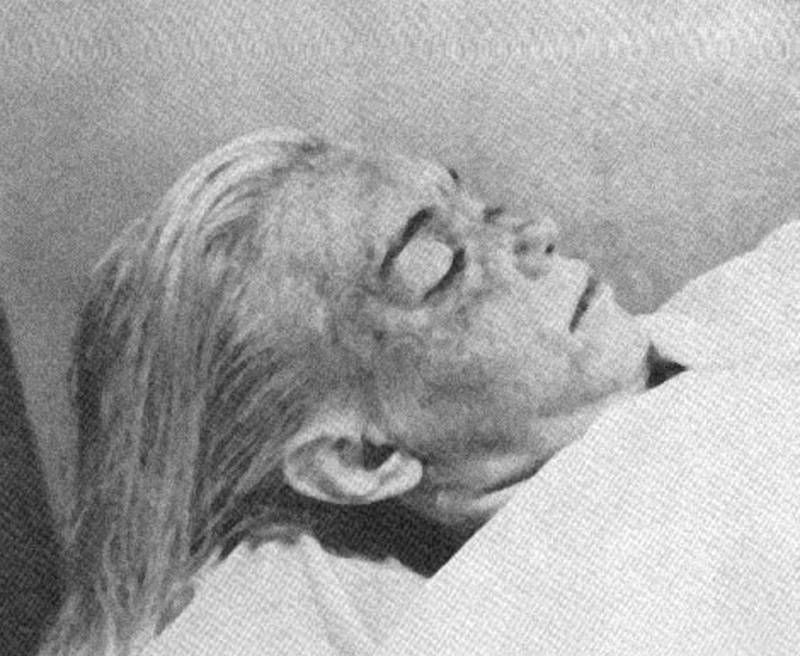 Marilyn Monroe en la morgue.