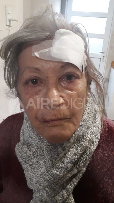 Golpearon a la dueña de una casa en barrio Mayoraz y se llevaron al televisor debajo del brazo
