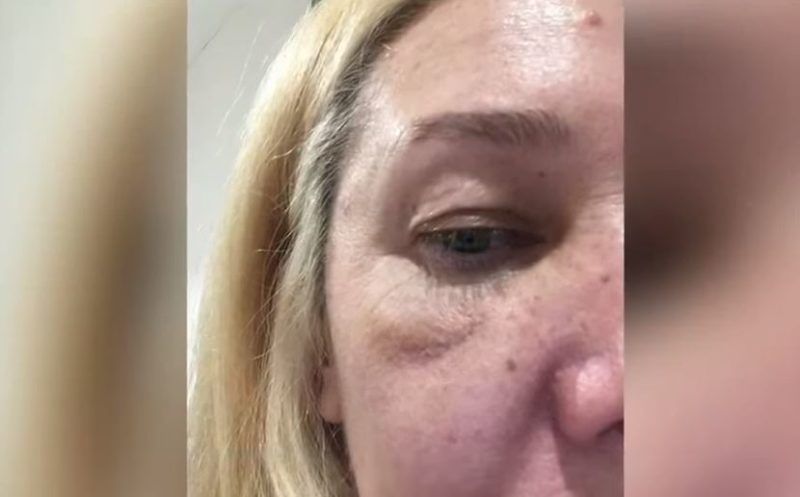 Mariana Nannis reveló cuándo fue la primera vez que Caniggia le levantó la mano