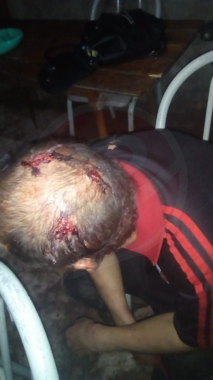 Secuestran a discapacitado, lo torturan, intentan violarlo y viralizan el video por WhatsApp