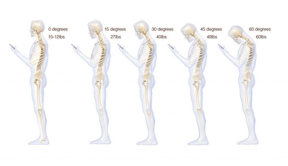 ¿Sabes cómo acabará tu columna de tanto usar WhatsApp?