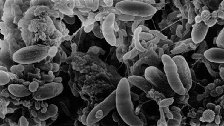 Una bacteria cobrÃ³ la vida del joven. (Foto: Archivo)