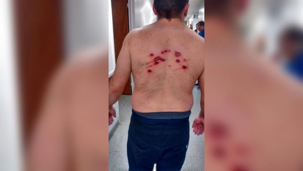 La policía lanzó gases lacrimógenos y balas de goma en Santa Cruz