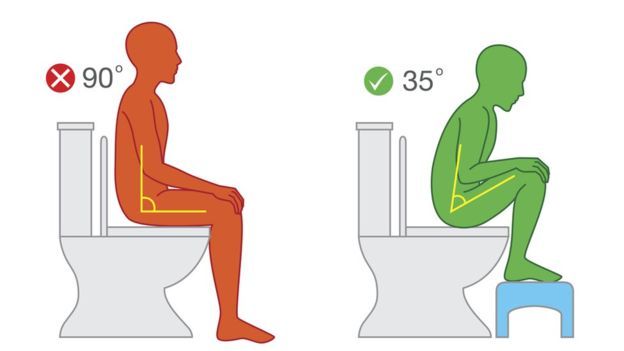 Ilustración de cómo mejorar la posición de 90 grados a 35 grados para ir al baño.