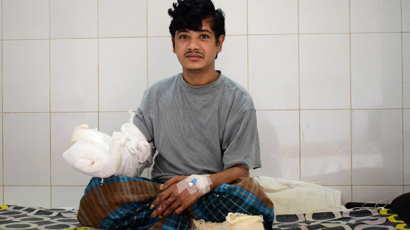 La notable mejorÃa en las manos del "hombre árbol" en 2017.