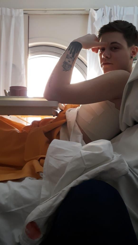 Lautaro recién operado de la mastectomÃa.