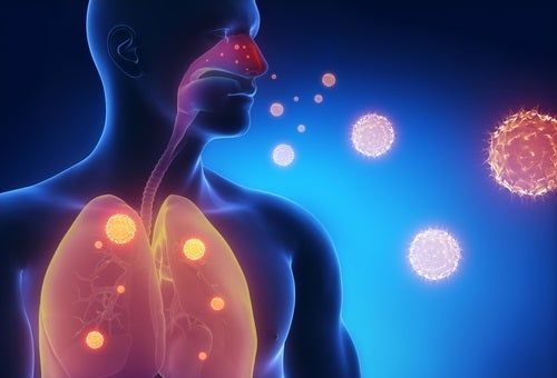 Dibujo de un hombre con imágenes de virus en sus pulmones.