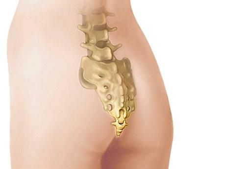 Resultado de imagen para coxis