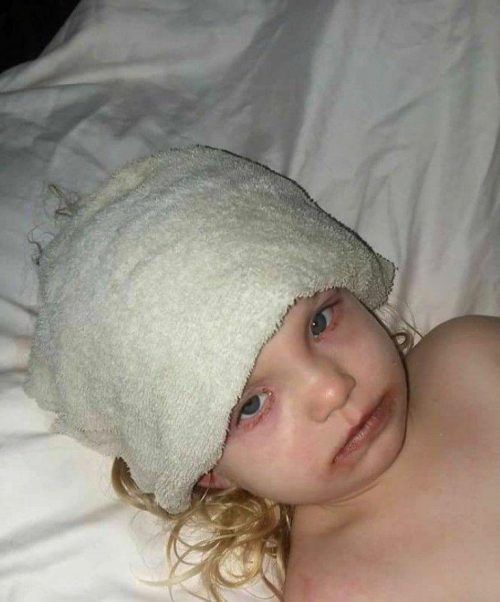Hospitalizan a una niña de 3 años minutos después de utilizar maquillaje de juguete