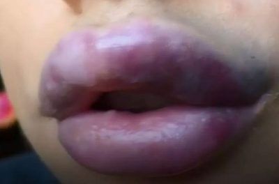 Los labios de la joven luego del tratamiento de belleza