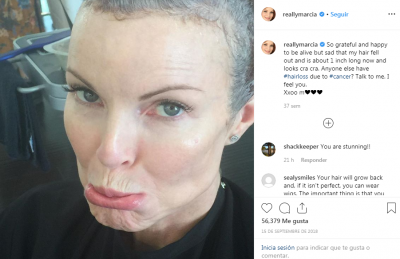 El duro momento de la actriz de “Desperate Housewives” tuvo cáncer anal y estaría relacionado al VPH de su esposo