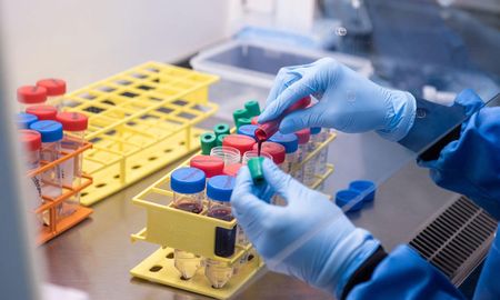 La OMC pidió que se donen dosis de vacunas desarrollada por la Universidad de Oxford y AstraZeneca para frenar el coronavirus. La OMC pidió que se donen dosis de vacunas desarrollada por la Universidad de Oxford y AstraZeneca para frenar el coronavirus.